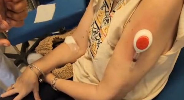 IBIMA participa en un proyecto para obtener muestras de sangre de forma menos invasiva